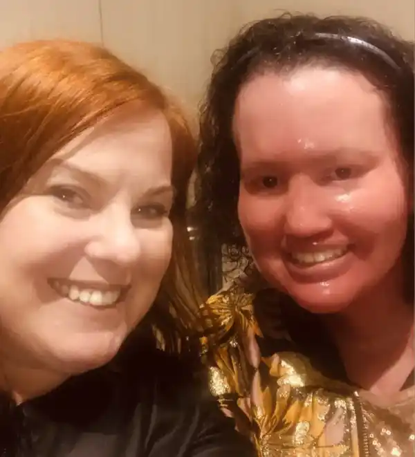 Carly Findlay - Author, Activist & Gorman lover