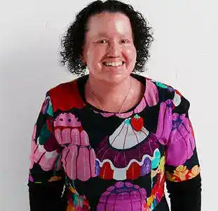 Carly Findlay - Contributor